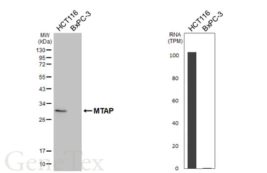 Anti-MTAP antibody [HL5682] used in Western Blot (WB). GTX646491