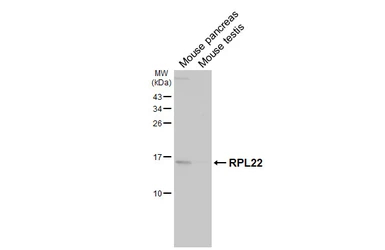 Anti-RPL22 antibody [HL5683] used in Western Blot (WB). GTX646492