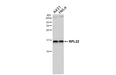 Anti-RPL22 antibody [HL5683] used in Western Blot (WB). GTX646492