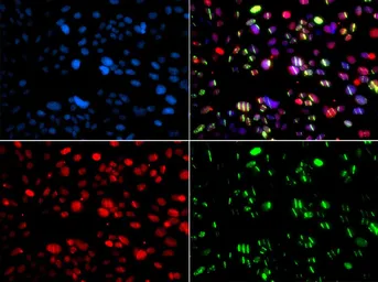 Anti-PNK antibody used in Immunocytochemistry/ Immunofluorescence (ICC/IF). GTX64651