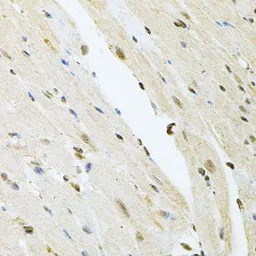 Anti-PNK antibody used in IHC (Paraffin sections) (IHC-P). GTX64651