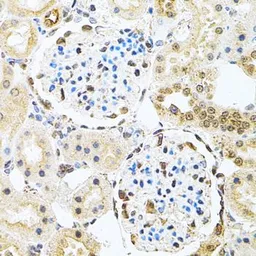 Anti-PNK antibody used in IHC (Paraffin sections) (IHC-P). GTX64651