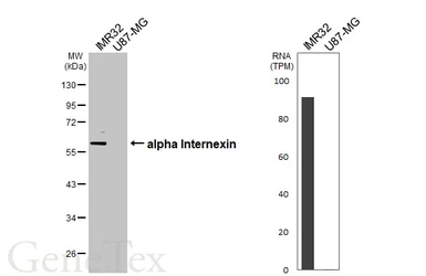 Anti-alpha Internexin antibody [HL5689] used in Western Blot (WB). GTX646520