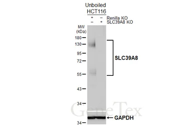Anti-SLC39A8 antibody [HL5690] used in Western Blot (WB). GTX646521