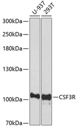 Anti-GCSF Receptor antibody used in Western Blot (WB). GTX64653