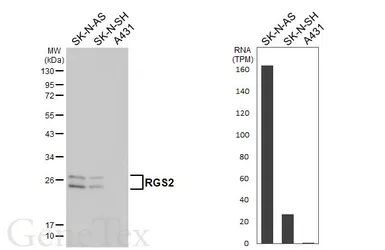 Anti-RGS2 antibody [HL5699] used in Western Blot (WB). GTX646530
