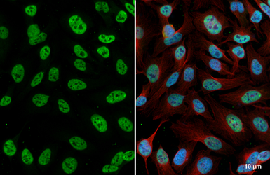 Anti-TDP43 antibody [HL5702] used in Immunocytochemistry/ Immunofluorescence (ICC/IF). GTX646533