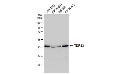 Anti-TDP43 antibody [HL5704] used in Western Blot (WB). GTX646535