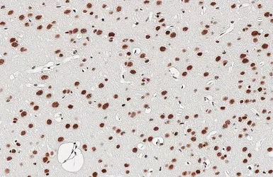Anti-TDP43 antibody [HL5704] used in IHC (Paraffin sections) (IHC-P). GTX646535