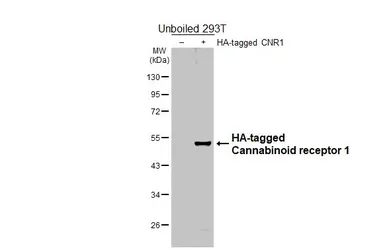 Anti-Cannabinoid receptor 1 antibody [HL5708] used in Western Blot (WB). GTX646539