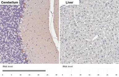Anti-Cannabinoid receptor 1 antibody [HL5708] used in IHC (Paraffin sections) (IHC-P). GTX646539