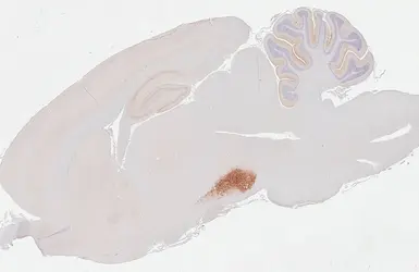 Anti-Cannabinoid receptor 1 antibody [HL5708] used in IHC (Paraffin sections) (IHC-P). GTX646539