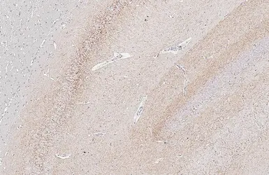 Anti-Cannabinoid receptor 1 antibody [HL5708] used in IHC (Paraffin sections) (IHC-P). GTX646539