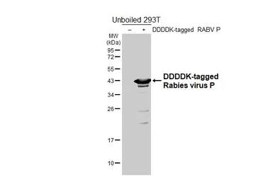 Anti-Rabies virus P antibody [HL5710] used in Western Blot (WB). GTX646541