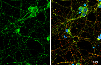 Anti-mGluR1 antibody [HL5720] used in Immunocytochemistry/ Immunofluorescence (ICC/IF). GTX646551