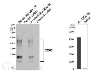 Anti-CD63 antibody [GT368] used in Western Blot (WB). GTX646552