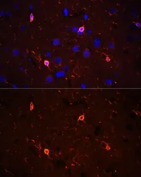 Anti-Coronin 1A antibody used in IHC (Paraffin sections) (IHC-P). GTX64657