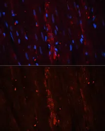 Anti-Coronin 1A antibody used in IHC (Paraffin sections) (IHC-P). GTX64657