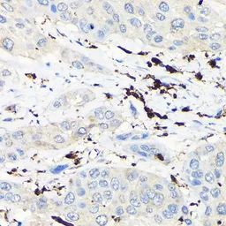 Anti-Coronin 1A antibody used in IHC (Paraffin sections) (IHC-P). GTX64657