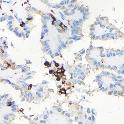 Anti-Coronin 1A antibody used in IHC (Paraffin sections) (IHC-P). GTX64657