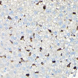 Anti-Coronin 1A antibody used in IHC (Paraffin sections) (IHC-P). GTX64657