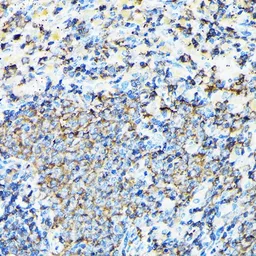 Anti-Coronin 1A antibody used in IHC (Paraffin sections) (IHC-P). GTX64657