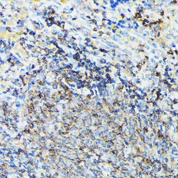 Anti-Coronin 1A antibody used in IHC (Paraffin sections) (IHC-P). GTX64657