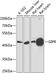 Anti-GIPR antibody used in Western Blot (WB). GTX64658