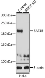 Anti-WSTF antibody used in Western Blot (WB). GTX64663