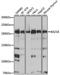 Anti-WSTF antibody used in Western Blot (WB). GTX64663