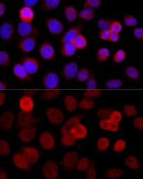 Anti-WSTF antibody used in Immunocytochemistry/ Immunofluorescence (ICC/IF). GTX64663