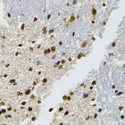 Anti-WSTF antibody used in IHC (Paraffin sections) (IHC-P). GTX64663