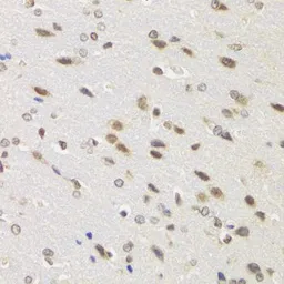 Anti-WSTF antibody used in IHC (Paraffin sections) (IHC-P). GTX64663