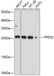 Anti-TPD52 antibody used in Western Blot (WB). GTX64664