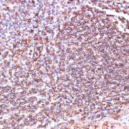 Anti-TPD52 antibody used in IHC (Paraffin sections) (IHC-P). GTX64664