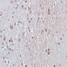 Anti-TPD52 antibody used in IHC (Paraffin sections) (IHC-P). GTX64664
