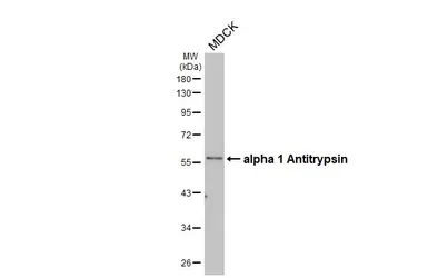 Anti-alpha 1 Antitrypsin antibody [HL5724] used in Western Blot (WB). GTX646675