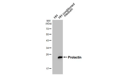 Anti-Prolactin antibody [HL5726] used in Western Blot (WB). GTX646677