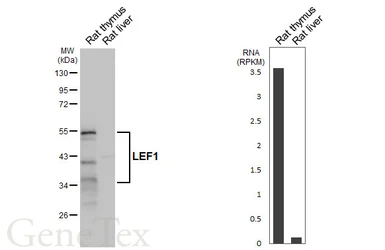 Anti-LEF1 antibody [HL5728] used in Western Blot (WB). GTX646679