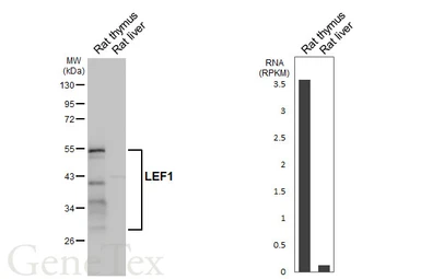 Anti-LEF1 antibody [HL5728] used in Western Blot (WB). GTX646679