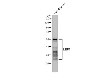 Anti-LEF1 antibody [HL5729] used in Western Blot (WB). GTX646680
