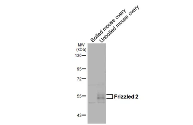 Anti-Frizzled 2 antibody [HL5743] used in Western Blot (WB). GTX646694
