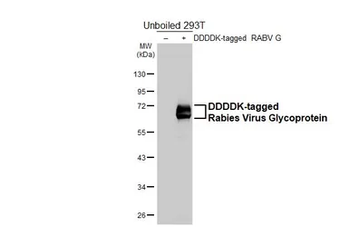 Anti-Rabies virus Glycoprotein antibody [HL5746] used in Western Blot (WB). GTX646697