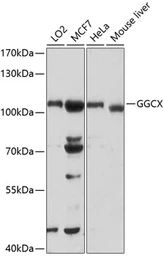 Anti-GGCX antibody used in Western Blot (WB). GTX64670
