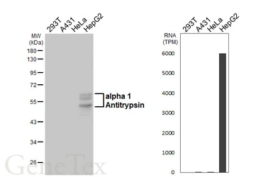 Anti-alpha 1 Antitrypsin antibody [HL5758] used in Western Blot (WB). GTX646709