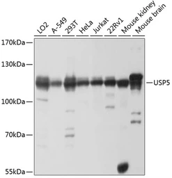 Anti-USP5 antibody used in Western Blot (WB). GTX64671