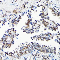 Anti-USP5 antibody used in IHC (Paraffin sections) (IHC-P). GTX64671