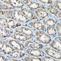 Anti-USP5 antibody used in IHC (Paraffin sections) (IHC-P). GTX64671