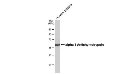 Anti-alpha 1 Antichymotrypsin antibody [HL5762] used in Western Blot (WB). GTX646713