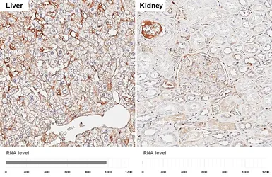 Anti-alpha 1 Antichymotrypsin antibody [HL5762] used in IHC (Paraffin sections) (IHC-P). GTX646713